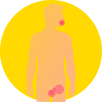 Primary Syphilis Icon